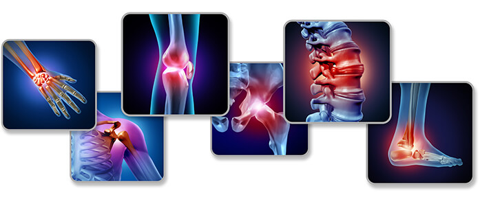Revolutionizing Joint Pain Treatment: Exploring Regenerative Medicine and the Best Chiropractor in South Florida